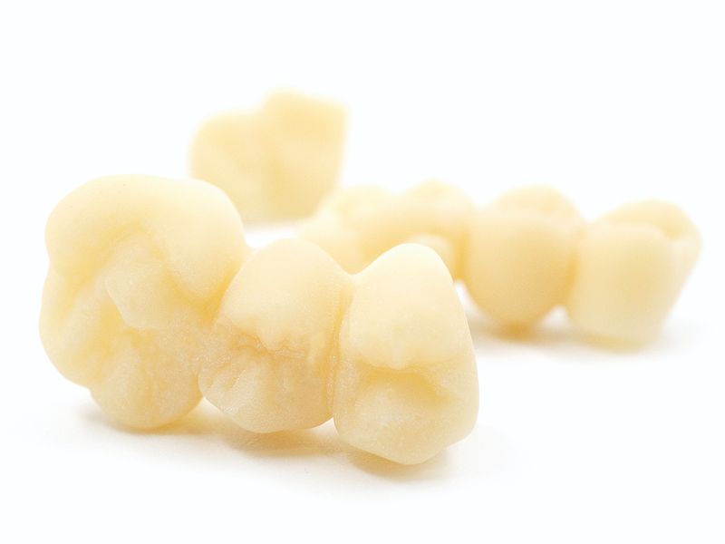 Coroas e pontes dentais impressos com a resina Dental Sand PRO